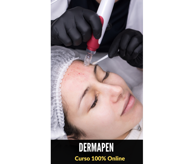 Dermapen Microneedling con Yess Lacroix
